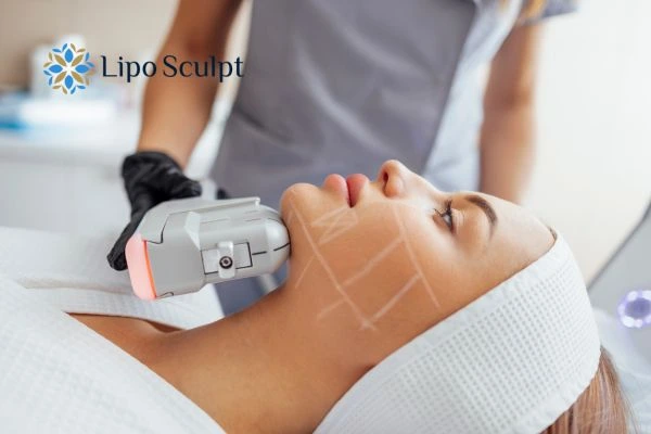 HIFU vs Botulinum Toxin: Understanding the Differences 1 HIFU vs Botox Colchester What is the best option for you?