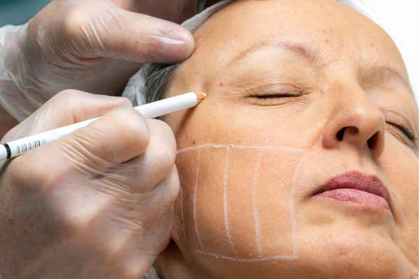 CryoPen: 5 Skin Concerns It May Be Used to Treat 4 What should you ask before having CryoPen treatment Colchester?